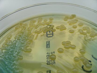 Cultivo de la 'Klebsiella pneumoniae' en agar.