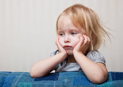 Ni&ntilde;a enferma de sarampi&oacute;n. 