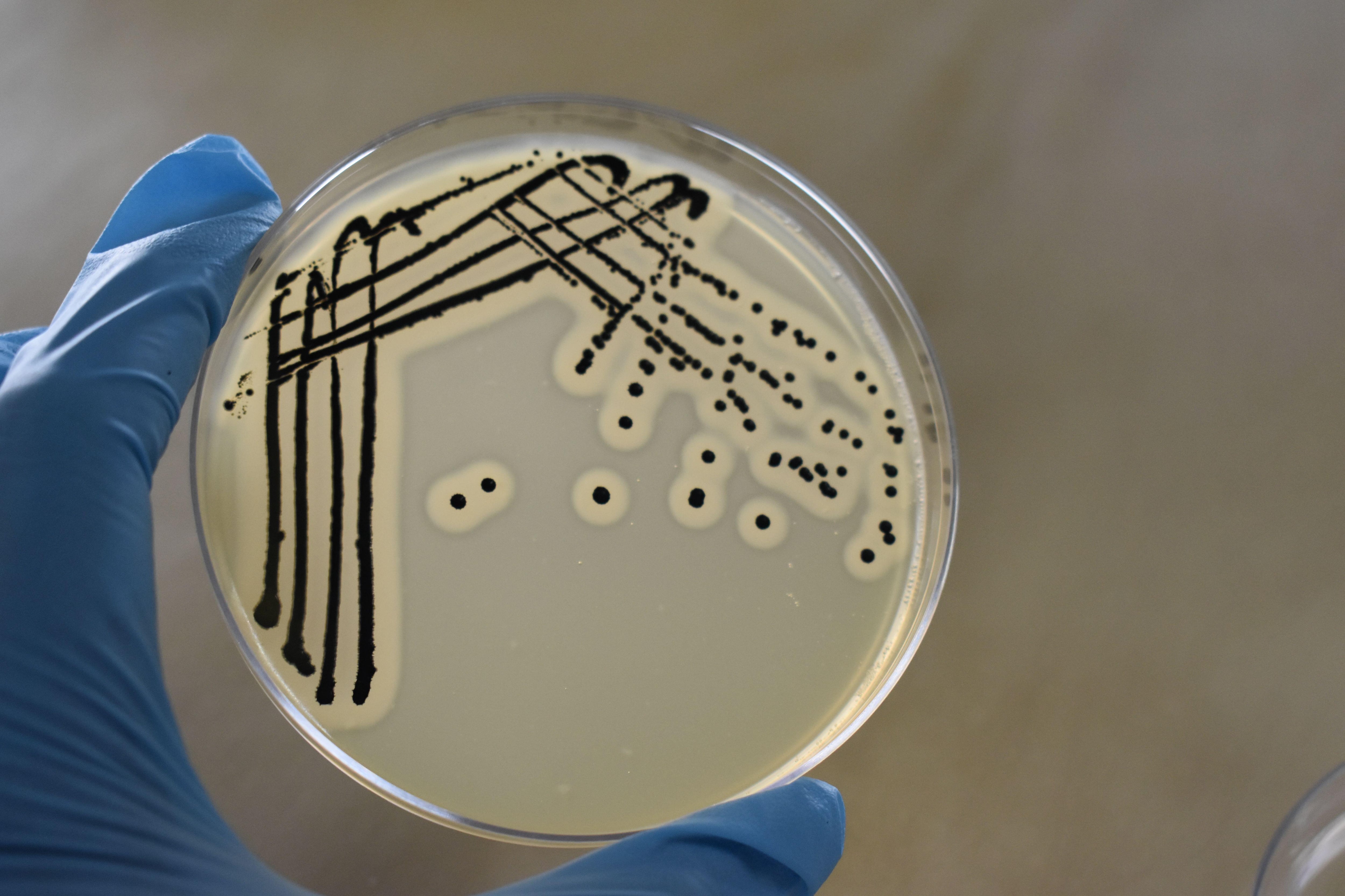 Descubierta la doble defensa de una superbacteria para sortear a los antibióticos