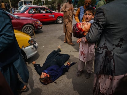 Una mujer y un niño, heridos por los talibanes en el aeropuerto de Kabul el 17.