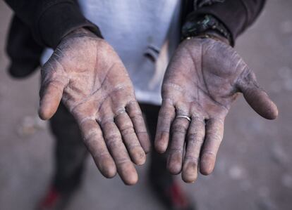 Un trabajador subsahariano de los invernaderos de Almería muestra sus manos en Níjar.