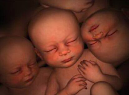 Imagen de una gestación de trillizos, del documental <i>En el vientre materno.</i>