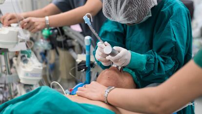 Imagen de una intubación a un paciente en un quirófano.