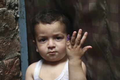 Un niño paquistaní muestra una marca en su dedo tras ser vacunado contra la polio. Pese a los esfuerzos de inmunización, se han registrado nuevos casos de esta enfermedad en el país.