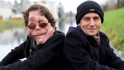 British actor Adam Pearson (left) with his twin brother Neil.