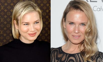 El antes y después de Renée Zellweger.