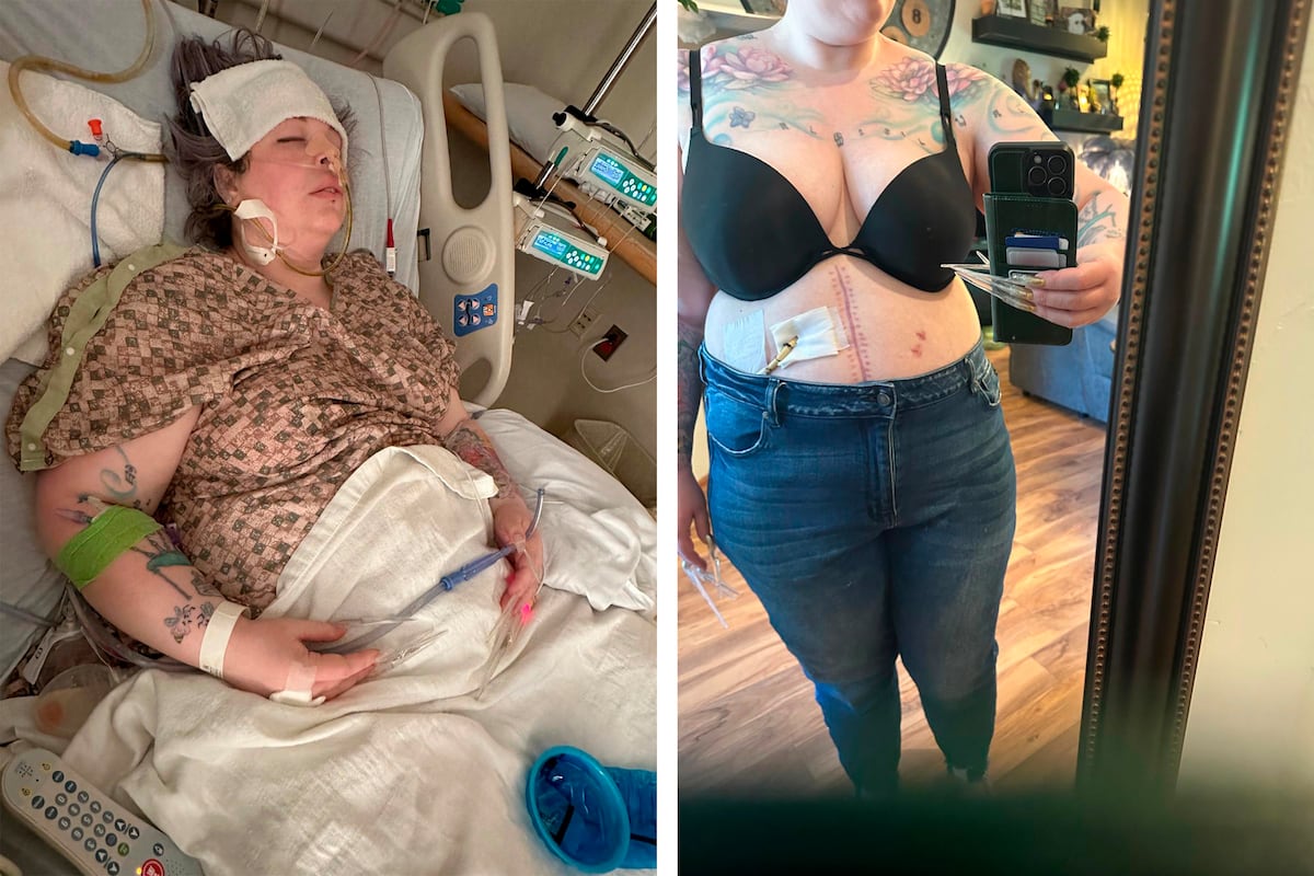 American Woman’s Weight Loss Nightmare in Tijuana