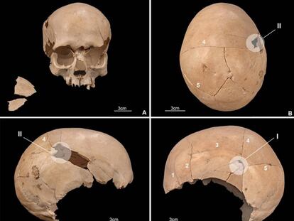 Cráneo de uno de los individuos asesinados en la cueva de Els Trocs, con impactos de flechas y objetos contundentes.