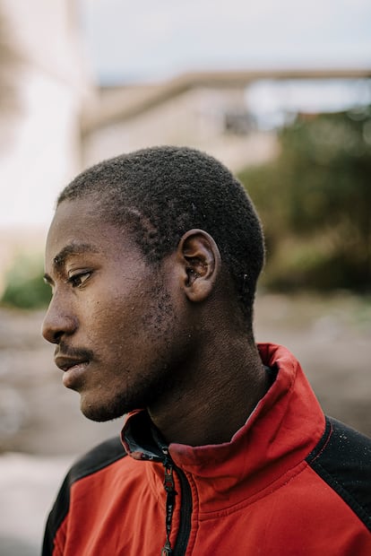 Abudak el Abdelkhader (20 años, Sudán) muestra la herida que asegura que fue provocada por la policía marroquí el 24 de junio en Melilla. “Era mi séptimo intento de cruzar a Europa. Los soldados marroquíes me acorralaron cuando estaba arriba de la valla. Caí y me golpearon. Me detuvieron, me metieron en la cárcel y pasé dos días incomunicado. Solicité en varias ocasiones que me llevaran al hospital porque estaba herido, pero nadie me quiso hacer caso. Al tercer día la situación era tan grave que decidieron llevarme al hospital de Fnideq (Castillejos) para que me curaran las heridas. A las pocas horas estaba en un autobús de vuelta hacia Casablanca”.