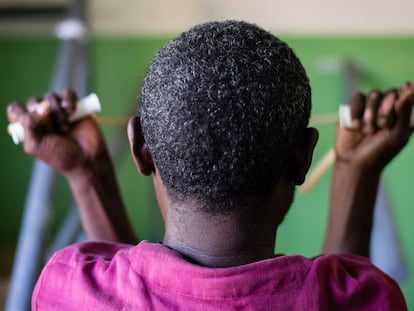 Ibrahim, diagnosticado con lepra, realiza ejercicios de rehabilitación en el hospital de Gambo, en Etiopía.