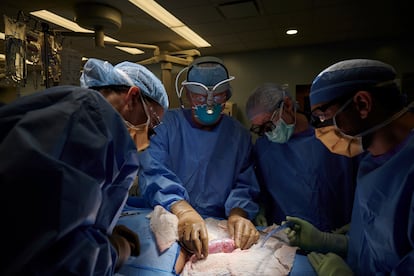 Cirujanos de un hospital de Nueva York examinan el posible rechazo de un riñón de cerdo en un paciente, en septiembre de 2021.