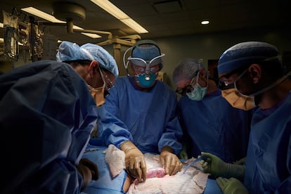 Surgeons at a New York hospital examine a patient for possible rejection of a pig kidney, in September 2021.