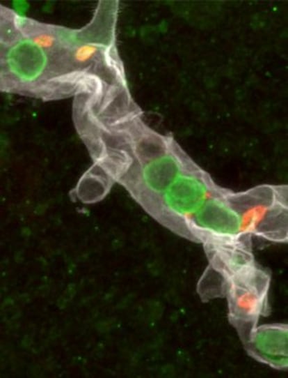 Imagen de un vaso cerebral después de un ictus. Lo neutrófilos aparecen teñidos de verde, y las plaquetas, de rojo.