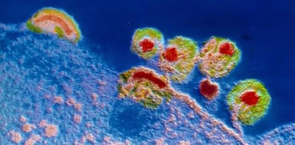 Microfotgraf&iacute;a coloreada del virus del sida.