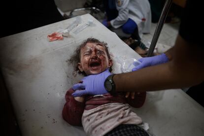 Un niño palestino, herido durante un bombardeo israelí en la Franja, recibe tratamiento en el hospital de Jan Yunis este viernes.