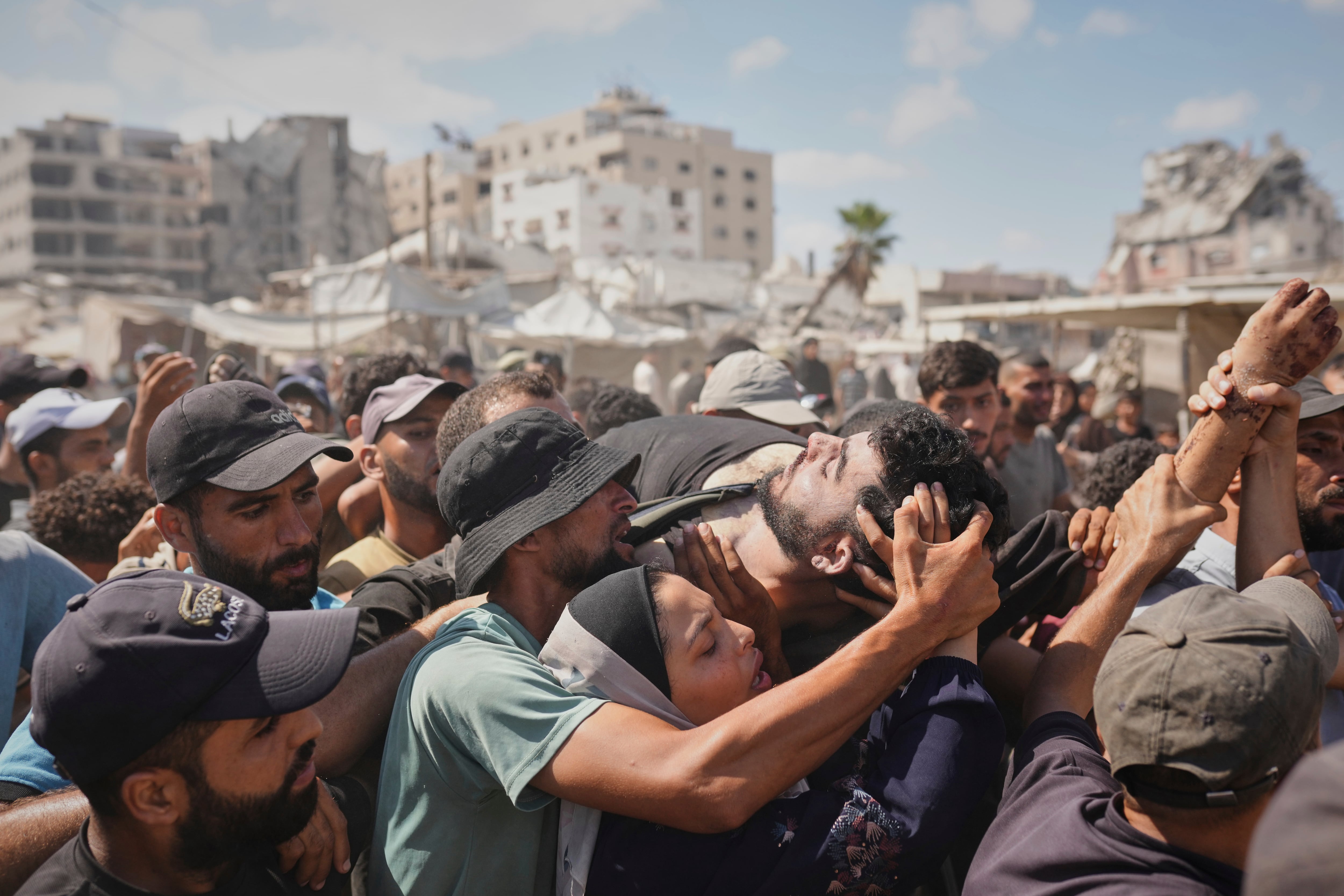 Médicos europeos tras abandonar Gaza: “Los animales tienen más derechos en el Reino Unido que los palestinos en su tierra”