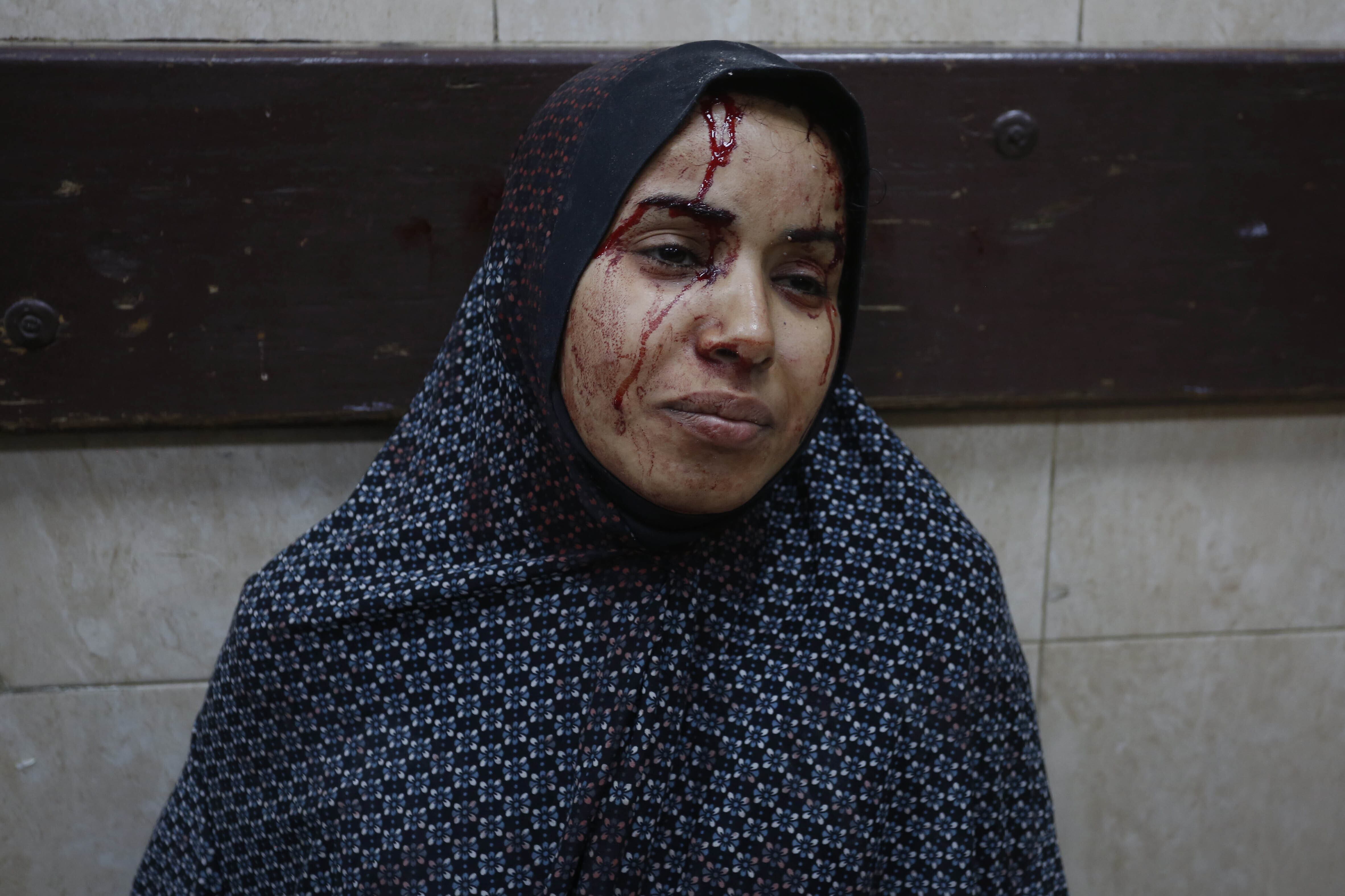 Una mujer herida en un ataque aéreo israelí es llevada al Hospital de los Mártires de Al Aqsa para recibir tratamiento.