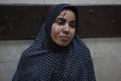 A woman injured in an Israeli airstrike is taken to Al Aqsa Martyrs Hospital for treatment.