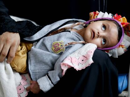 A girl with cancer lies on the lap of her mother at The National Oncology Centre in Sanaa, Yemen, August 6, 2018. REUTERS/Khaled Abdullah SEARCH