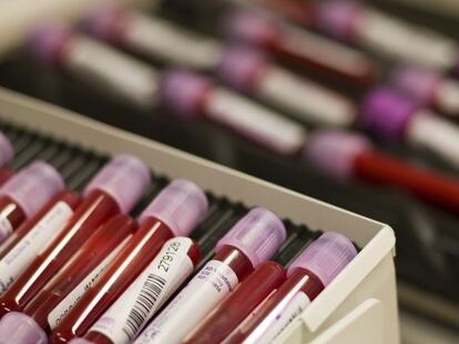 Muestras de sangre analizadas en un laboratorio. 