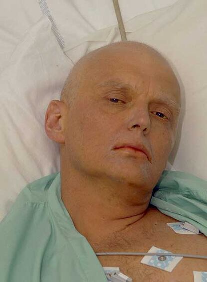 El espía Alexander Litvinenko.