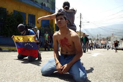 A boy with blood on his chest kneels in front of police after a student died during a protest in San Cristóbal.