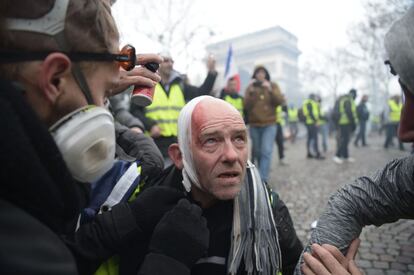 La Prefectura de París asegura que entre los concentrados hay infiltrados miembros de grupos de ultraderecha, según 'Le Figaro'. En la imagen, un manifestantes herido es ayudado durante la marcha.