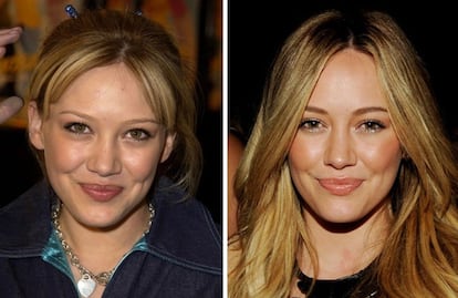 El cambio en la actriz y cantante Hilary Duff es casi imperceptible. En estas dos fotos, con más de diez años de diferencia, su nariz se ve ligeramente más pequeña y definida. 