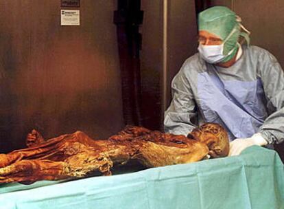 Expertos examina el cuerpo de Ötzi en 2001