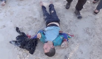 Un niño afectado por el supuesto ataque con armas químicas en la localidad rebelde siria de Jan Sheijun. Han muerto mas de 50 personas en la operación, denunciada por Francia al Consejo de Seguridad de la ONU.