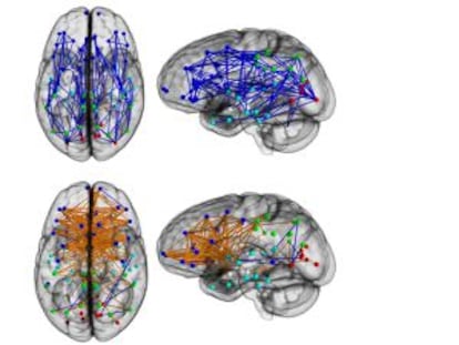 O cérebro de mulheres e homens mostra diferente conectividade
