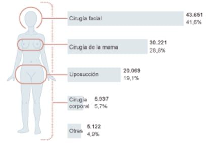 Intervenciones estéticas en España.