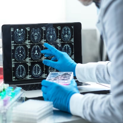 Neurology research, conceptual image. Scientist viewing a patient's brain scan during clinical tests in the lab