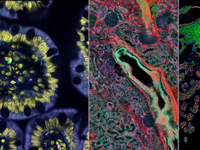 Tres imágenes de la estructura celular del intestino delgado (izquierda), riñón (centro) y placenta.