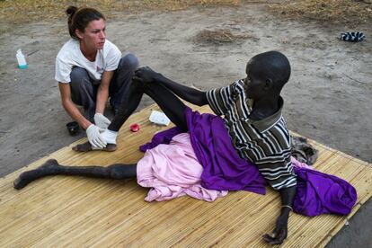Crystal, enfermera de MSF en Leer, revisa una herida que tiene en el tobillo George Tut, paciente del centro, mientras su hija Nyakuoth, de dos años, observa. George fue disparado el pasado 13 de octubre cuando una docena de hombres atacaron su aldea. 
