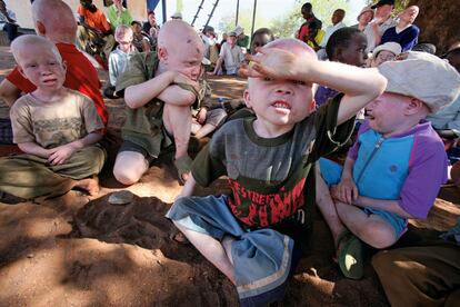 Muchos albinos acaban refugiados en lugares secretos ante lo inminente de su ejecución. Estos niños están acogidos en las escuelas Buhangiya, en Shinyanga, al norte de Tanzania.