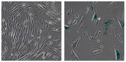 C&eacute;lulas madre humanas normales (izquierda) y envejecidas mutando su gen WRN.