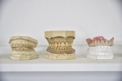 Tres moldes de dentadura postiza. Cuando Ana María Álvarez entró al negocio, las piezas eran de porcelana.