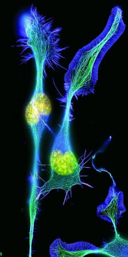 Células de neuroblastoma I diferenciándose en cultivo (Wittmann), University of California (UCSF), San Francisco, de la exposición 'Paisajes neuronales'.