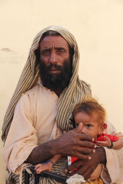 Jongel Bugti, de 40 años, lleva a su sobrino al programa de alimentación terapéutica de MSF en la localidad de Dera Allah Yar. "Tiene un año y pesa 5,5 kilos. Esta es la cuarta vez que le traemos hasta aquí porque cerró el centro que había en mi ciudad, Sobaptur. Así que ahora tenemos que pagar el transporte, pero merece la pena porque el tratamiento beneficia a nuestros pequeños. Creo que les dan una especie de pasta que llama Plumpy Nut y entonces mejoran", explica.