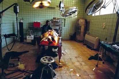 Hospital Al Karj, Irak, Mayo 2003. Perteneciente a la serie <i>¿Postguerra</i>. Un joven de 18 años es intervenido tras pisar una mina. Dos días después su pierna izquierda le fue amputada.