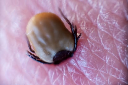 A macro photograph of a tick biting into the skin of a person