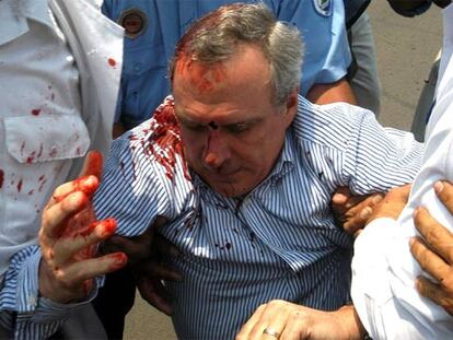 Enrique Bolaños Abaunza, hijo del presidente de Nicaragua, tras ser agredido el martes por los manifestantes.