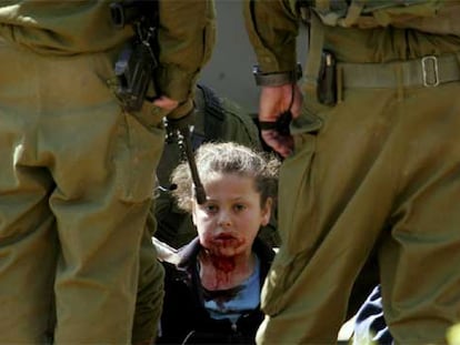 La niña palestina Nesreen Hash, de 8 años, herida por una pelota de goma durante una operación militar israelí en Hebrón (Cisjordania).