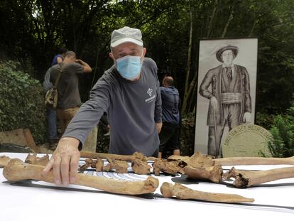 El forense Francisco Etxeberria manipula los restos óseos de Mikel Joakin Eleicegi, el gigante de Altzo, descubiertos en el cementerio del pueblo.