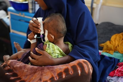 Una madre sostiene a su hijo desnutrido, al que alimenta con una jeringa en el Hospital Regional de Bay, apoyado por MSF. Muchos niños llegan en estado crítico debido al retraso en el acceso a la atención médica.