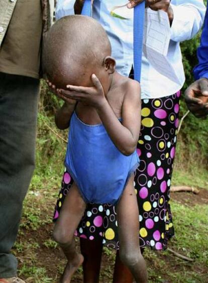 Médicos de una ONG pesan a un niño desnutrido en Etiopía.