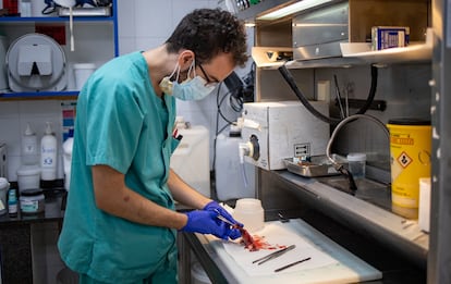 Cristian Benavides, médico residente en el Hospital Puerta del Mar de Cádiz, secciona un trozo de útero canceroso extirpado.