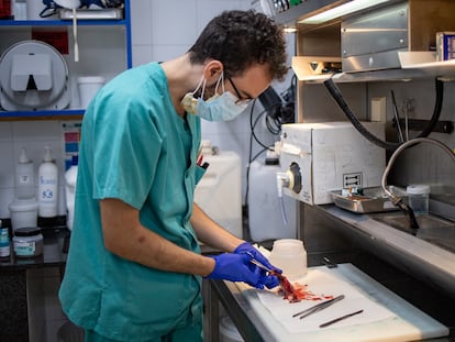 Un especialista patólogo trabaja con una muestra de tejido en la unidad de Anatomía Patológica del Hospital Puerta del Mar en Cádiz.