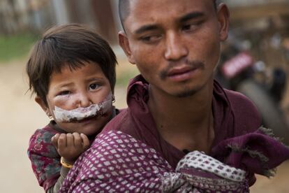 Un padre traslada a su hijo herido a un campamento de desplazados en Chautara, Nepal 